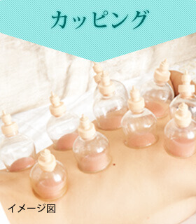 カッピング