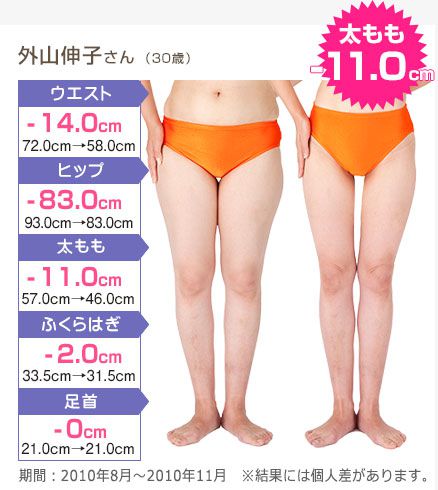 外山伸子さん （30歳） 太もも
-11.0cm