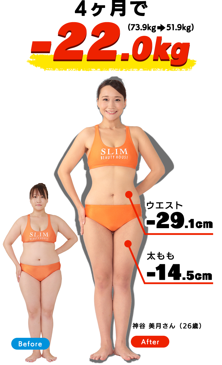 神谷美月さん（26歳）4ヶ月で-22.0kg ウエスト-29.1cm　太もも-14.5cm