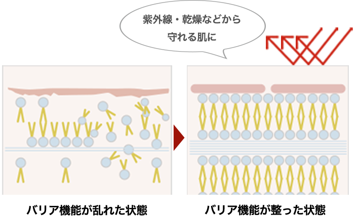 毛穴引締め美顔｜エステならスリムビューティハウス