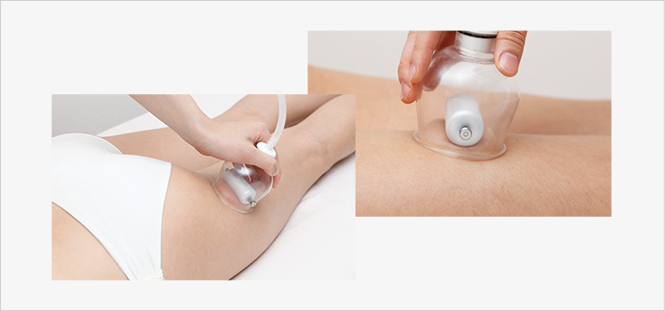 Geローラーカップ